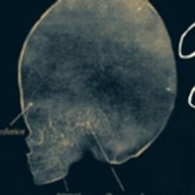 ROUND HEADS AND POINTED HEADS Is Jeff Recommended!