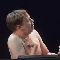 BWW REVIEW: 'THE ELEPHANT MAN' COMES IN FROM THE COLD AT NEW REP