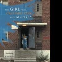 Delena Smith Writes About Childhood with Alopecia
