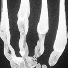 POPTONE Comes to Boulder Theater