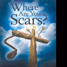 Rev. Lawrence P. Lakey Asks WHERE ARE YOUR SCARS?