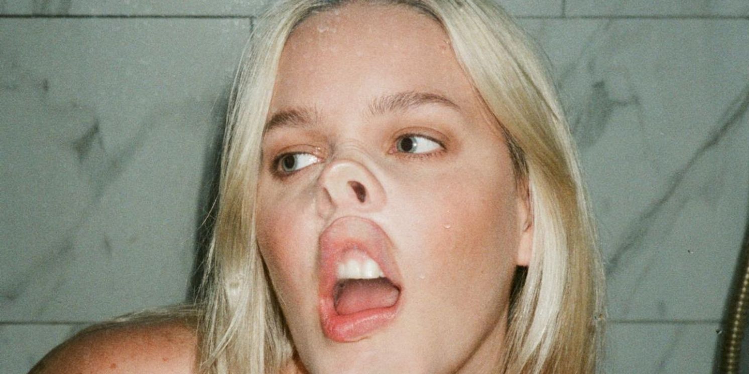 Anne-Marie Teams Up With Shania Twain for 'Unhealthy'  Image