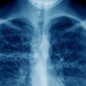 NOVA's THE BATTLE TO BREATHE Documentary to Premiere on PBS