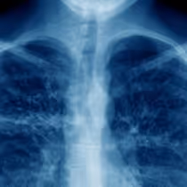 NOVA's THE BATTLE TO BREATHE Documentary to Premiere on PBS