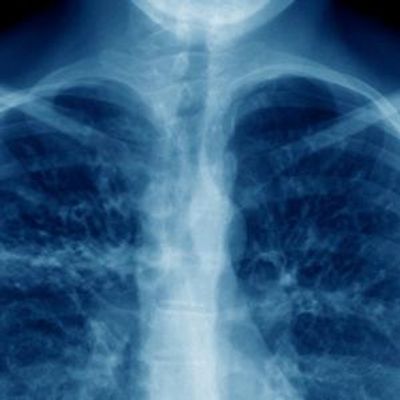 NOVA's THE BATTLE TO BREATHE Documentary to Premiere on PBS