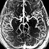 MICHAELA'S FLUENT APHASIA to be Presented at the McClintock Theatre This Month