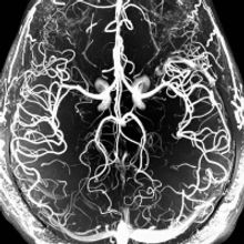 MICHAELA'S FLUENT APHASIA to be Presented at the McClintock Theatre This Month