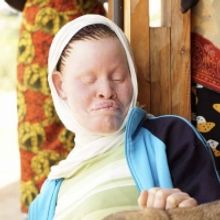 Tanzania Albinism Collective Release New Single