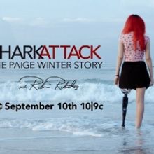 ABC News Presents An Exclusive Primetime Special On 17-Year-Old Shark Attack Survivor