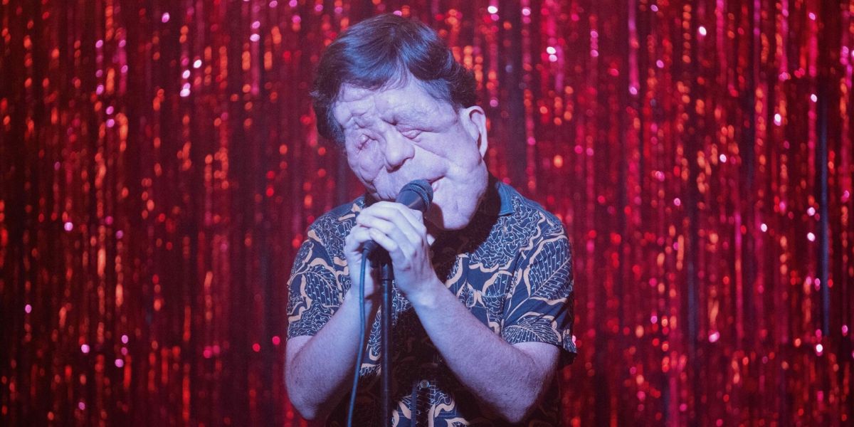 Adam Pearson to Play Joseph Merrick in THE ELEPHANT MAN Film Adaptation