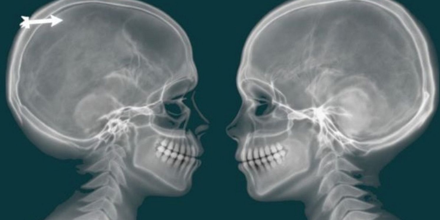 Kristen Cosby Premieres WHEN THE SKELETON DOES NOT STAND At Playground Solofest  Image