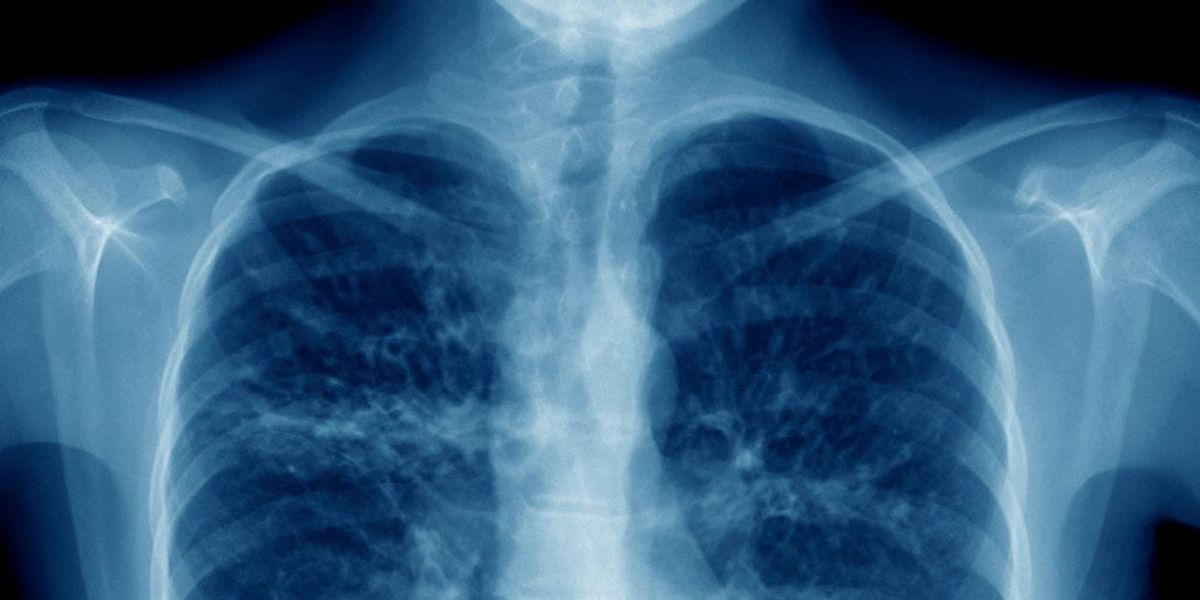 NOVA's THE BATTLE TO BREATHE Documentary to Premiere on PBS