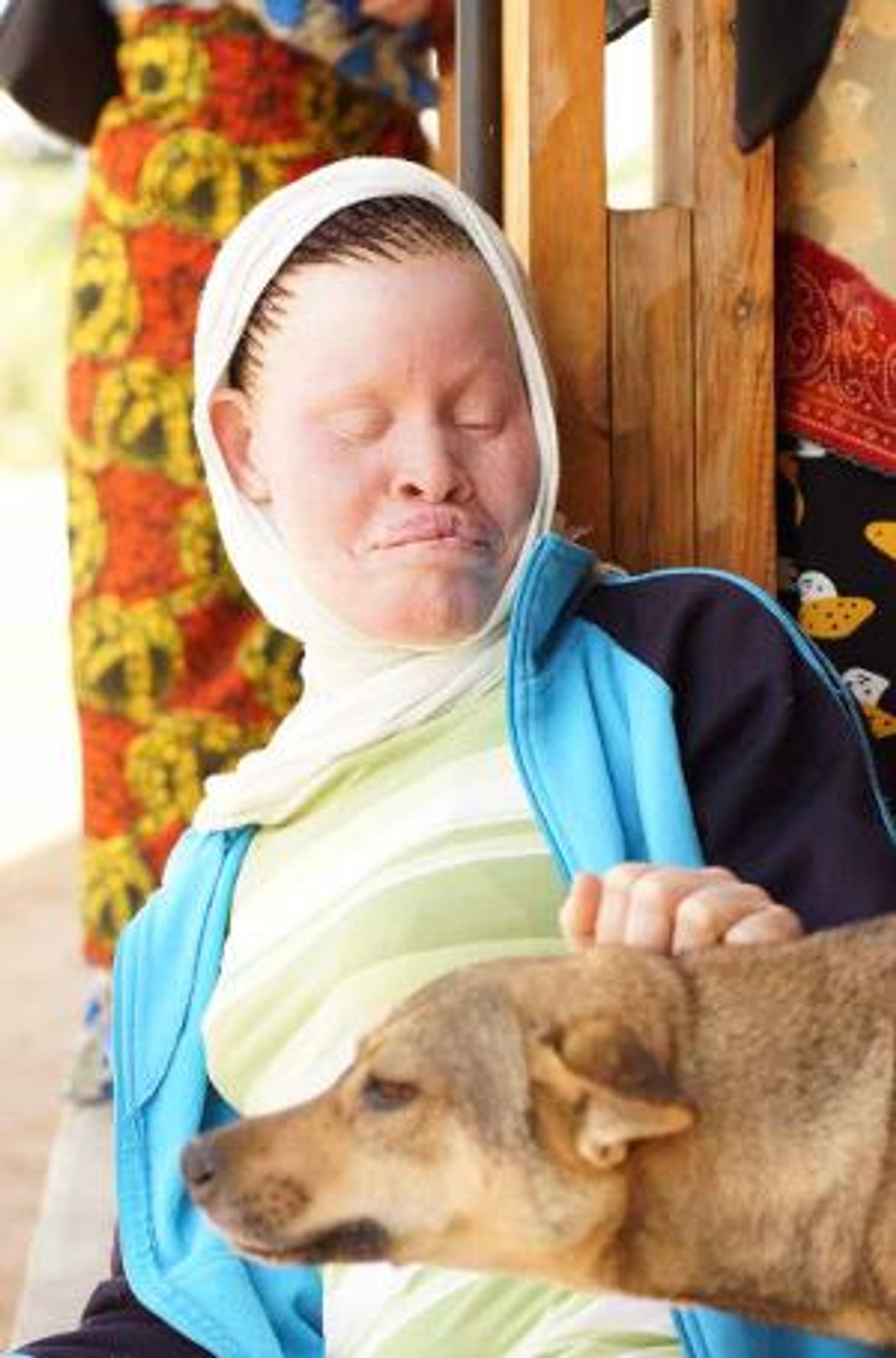 Tanzania Albinism Collective Release New Single  Image