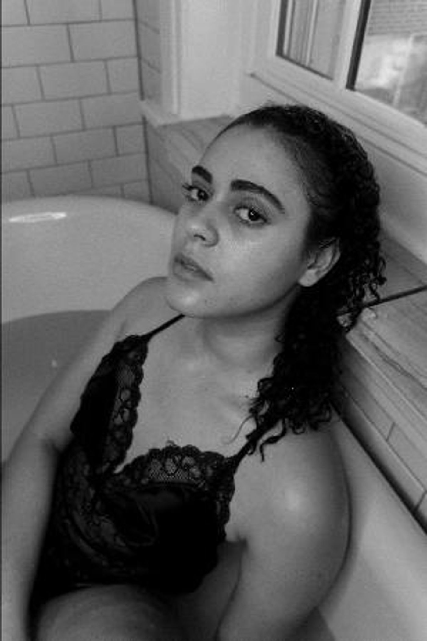 Mandy Groves Sustained Several Serious Injuries In Car Accident And Turns It Into An EP  Image