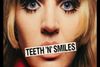 Teeth 'N' Smiles West End
