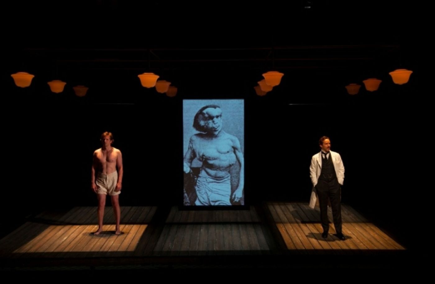 Photo Flash: Bradley Cooper, Patricia Clarkson and More in THE ELEPHANT MAN at Williamstown Theatre Festival  Image