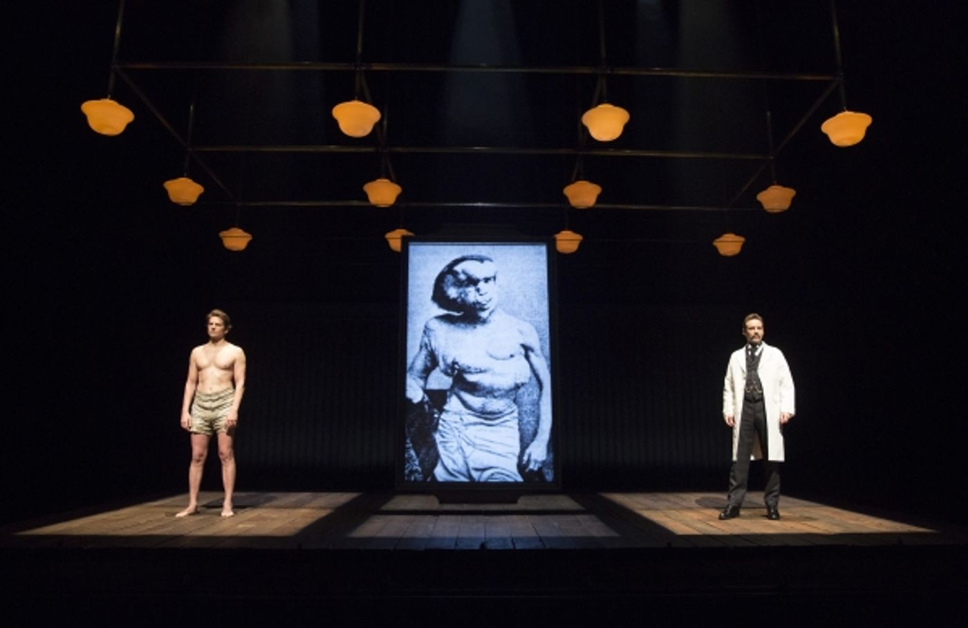 Photo Flash: First Look at Bradley Cooper, Patricia Clarkson & More in THE ELEPHANT MAN on Broadway  Image