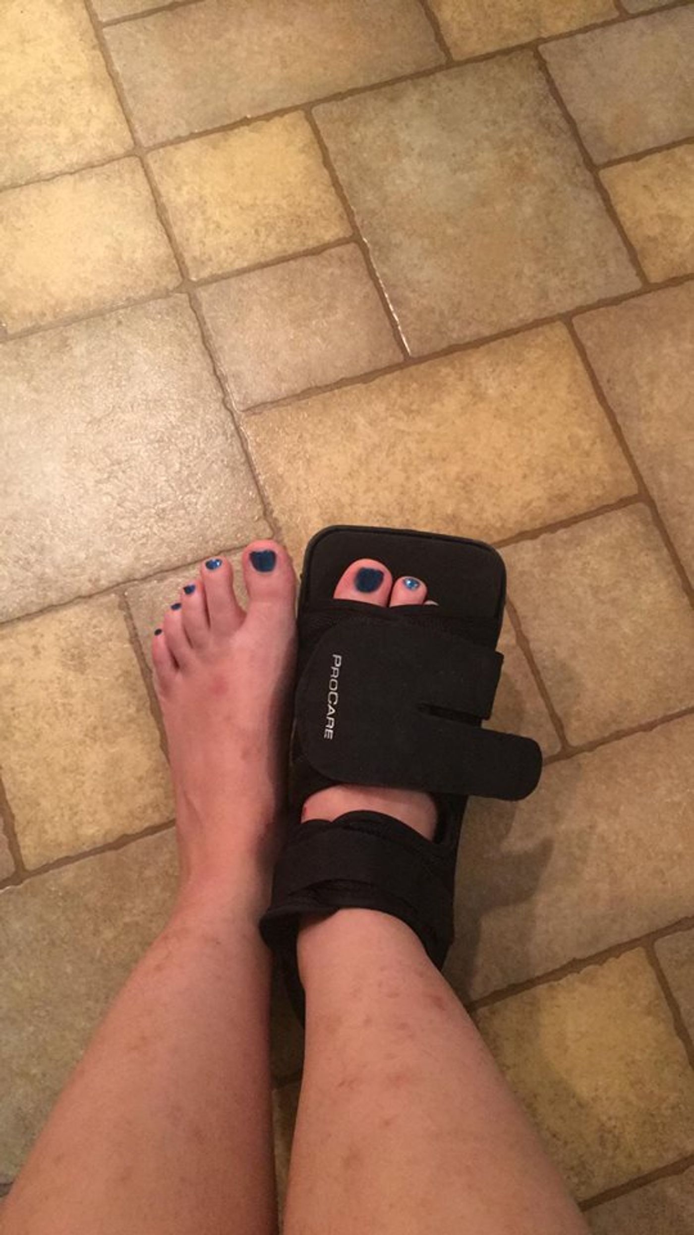 BWW Blog: The Road to Go Back Mentally and Physically  Image