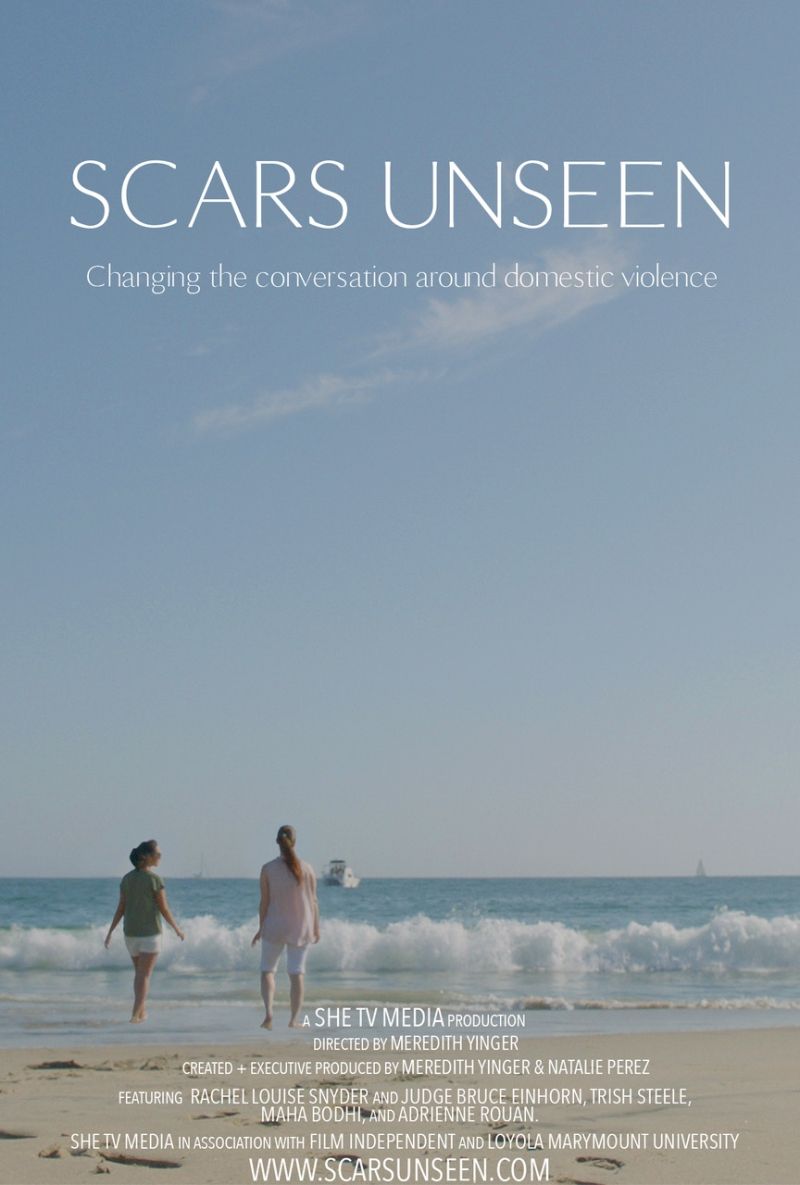 SCARS UNSEEN Documentary Feature Film World Premieres At Dances With Films SCARS UNSEEN Documentary Feature Film World Premieres At Dances With Films Image