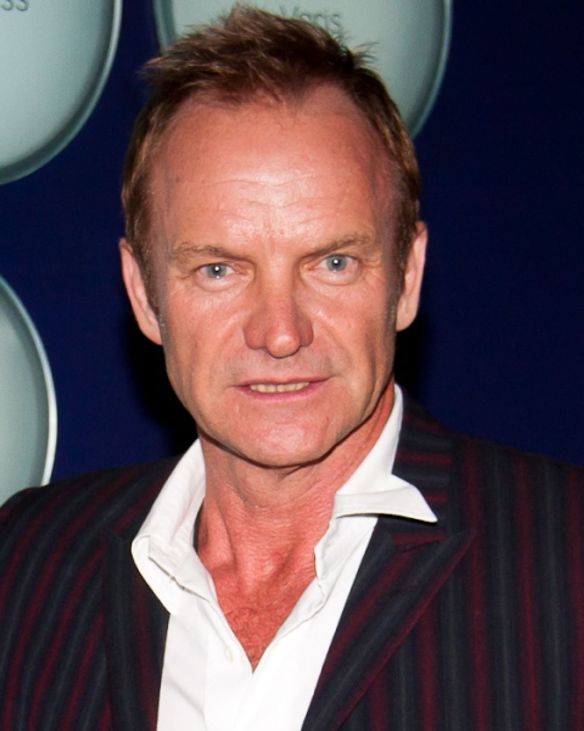 Sting at 