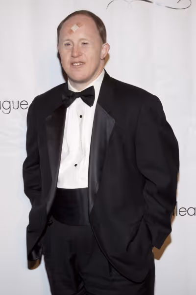 Chris Burke Photo