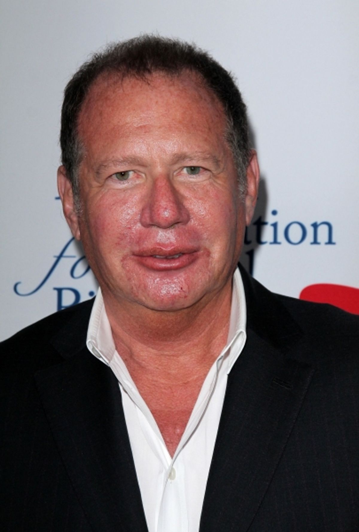 Garry Shandling at 